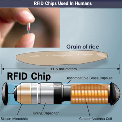 rfid tags in humans